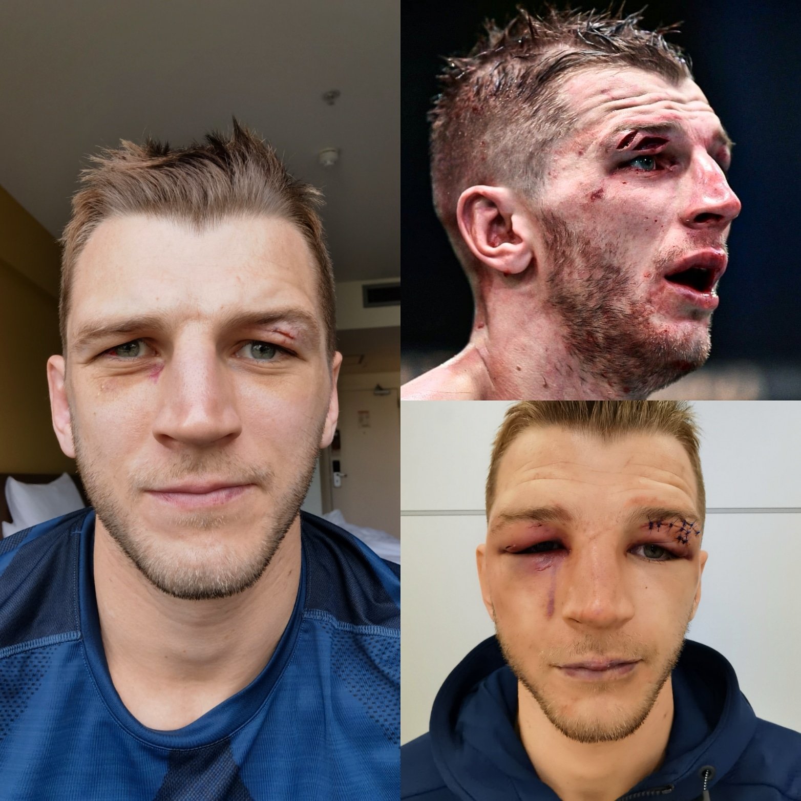 Dan Hooker showed off his recovery after losing to Dustin Poirier