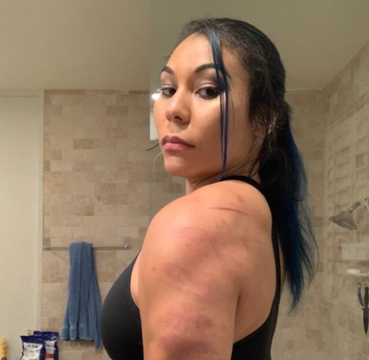 Mia Yim shows off her injury marks at the Great American Bash