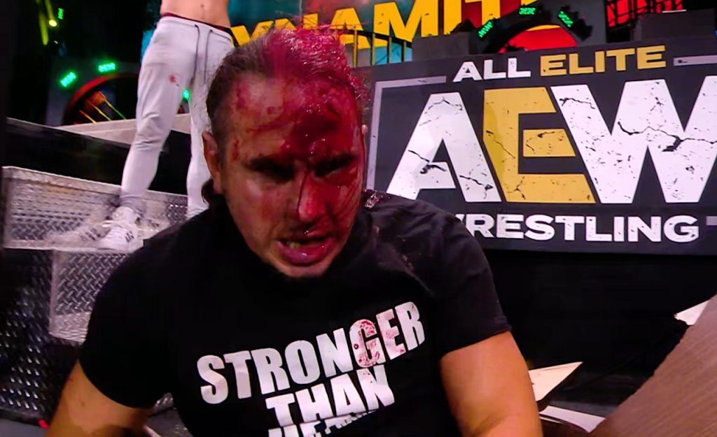 A bloodied Matt Hardy after Sammy Guevara attacked him which led to a head injury