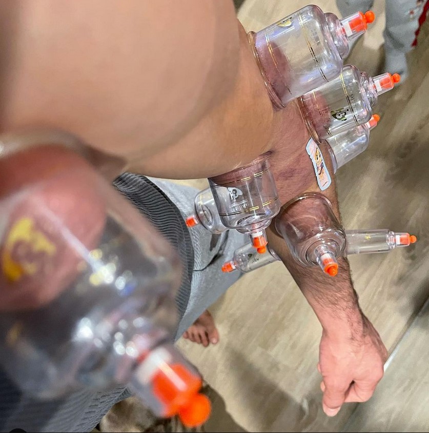 Tony Ferguson provided an update on his arm after UFC 256
