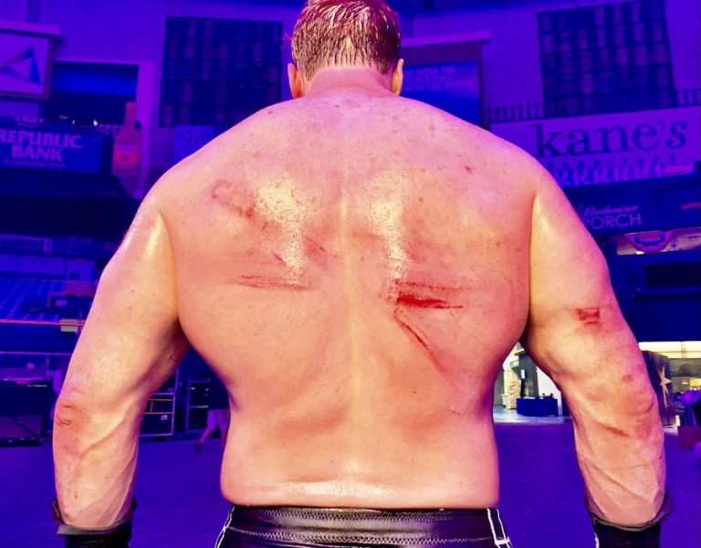 Sheamus shows off injury marks from Fastlane Drew McIntyre clash