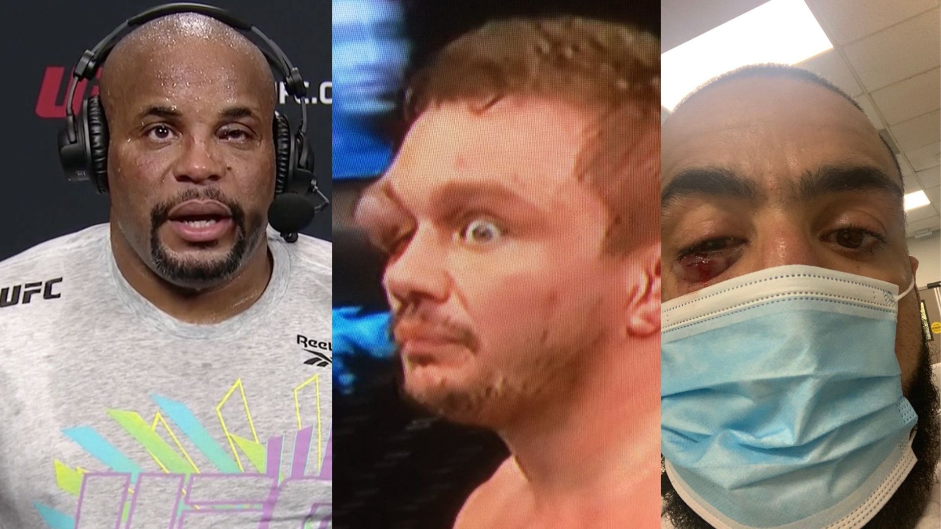 There have been some brutal eye pokes in the history of the UFC