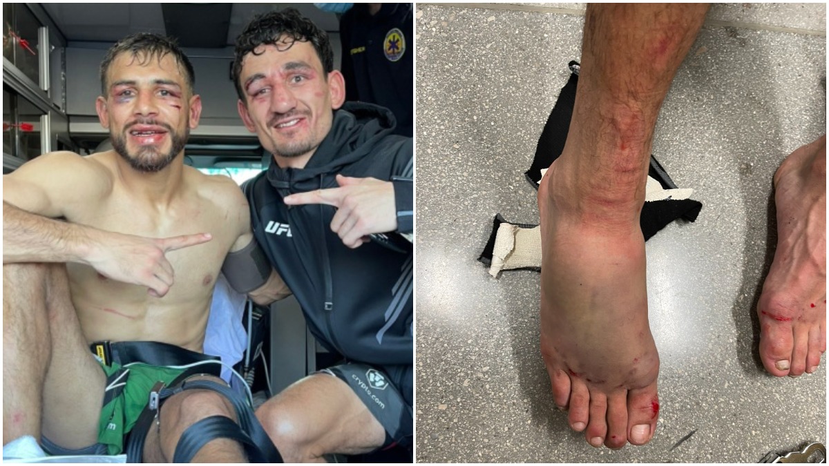 Yair Rodriguez foot injury