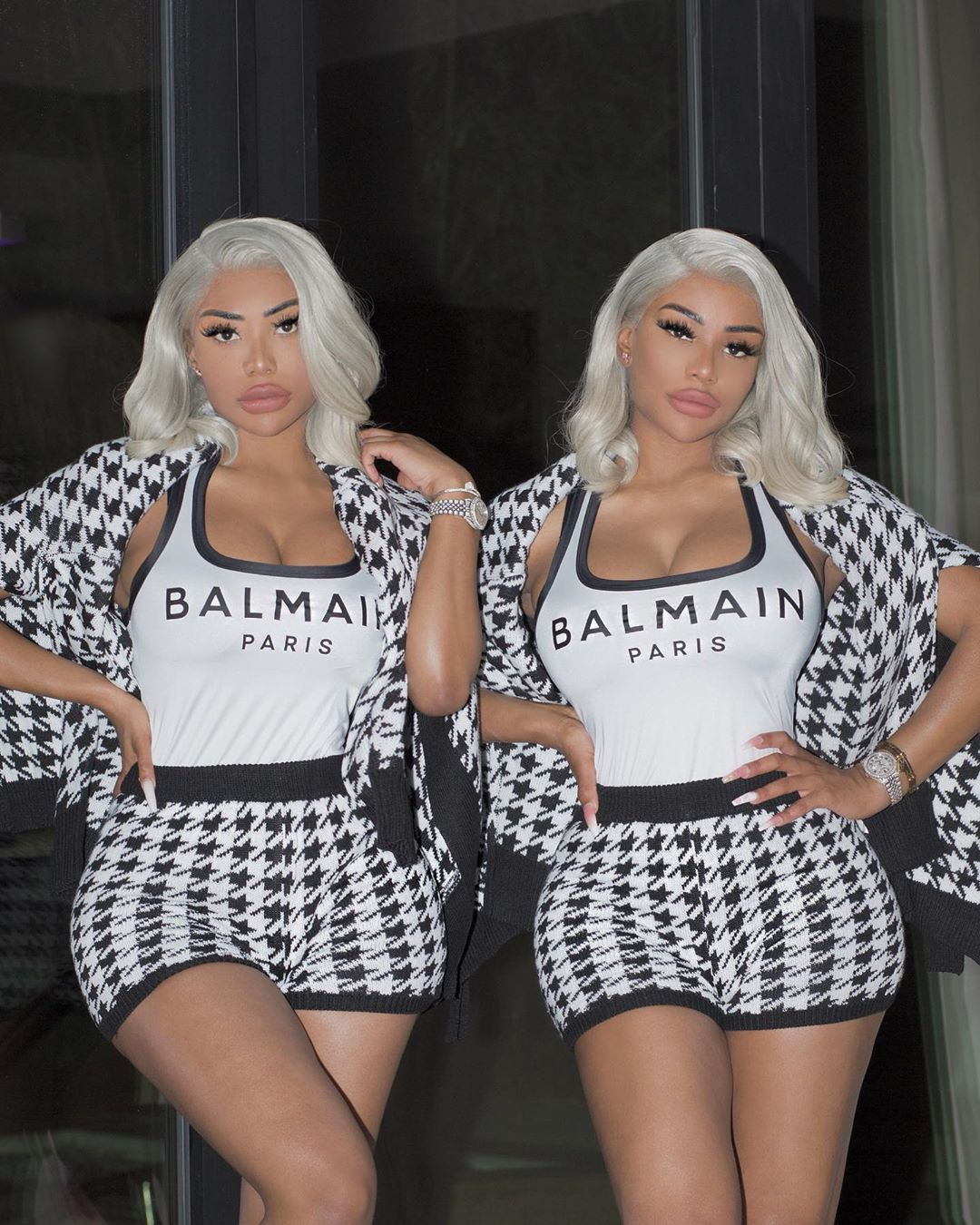 How Did The Clermont Twins Look Before Surgery