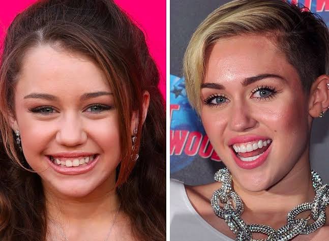 Does Miley Cyrus have fake teeth? What is the truth behind the rumours?
